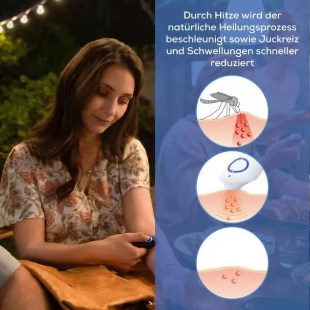 Beurer Insektenstichheiler